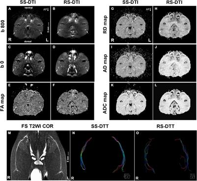 Performance of Single-Shot Echo-Planar Imaging in Diffusion Tensor Imaging in Rat Sciatic Nerve Compared With Readout-Segmented Echo-Planar Imaging